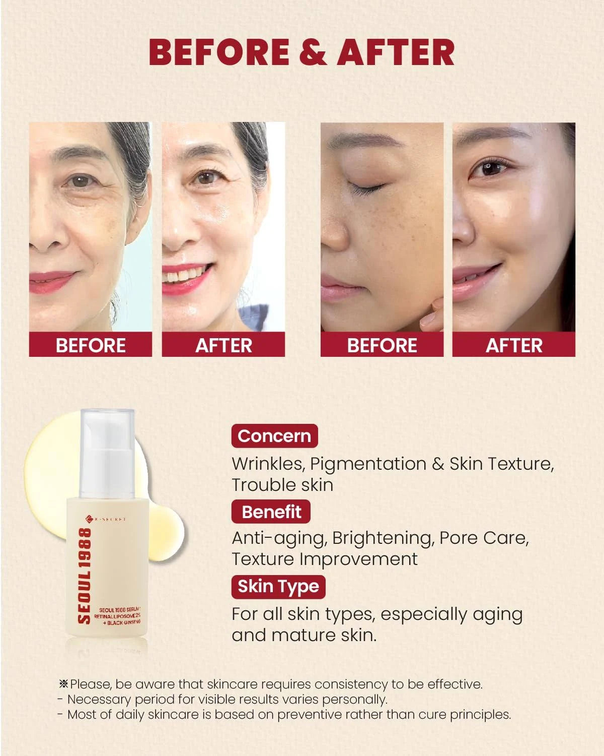 KSECRET - SEOUL 1988 Serum : Retinal Liposome 2% + Black Ginseng